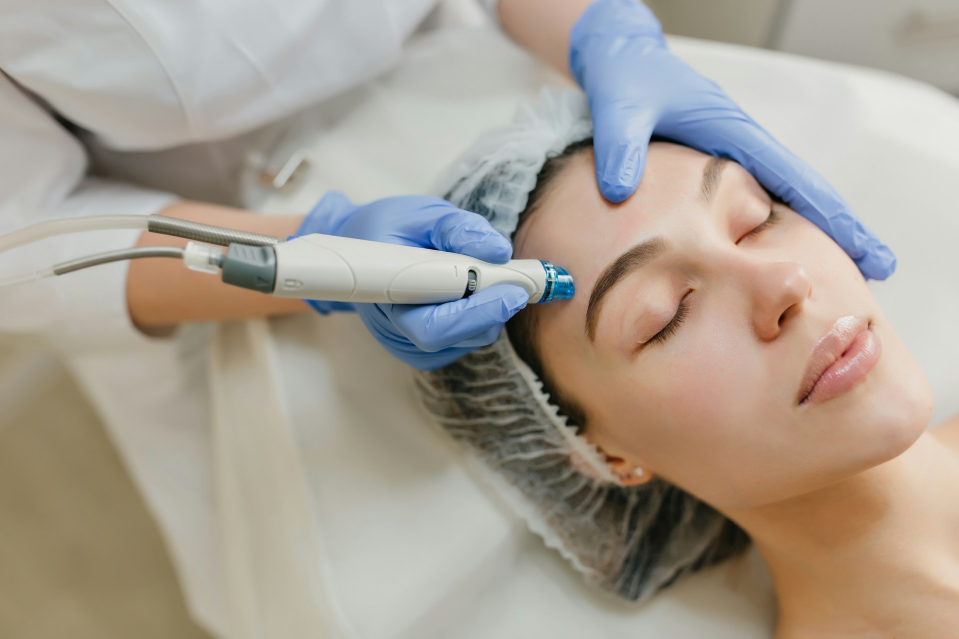 Avantages de l'épilation faciale au laser