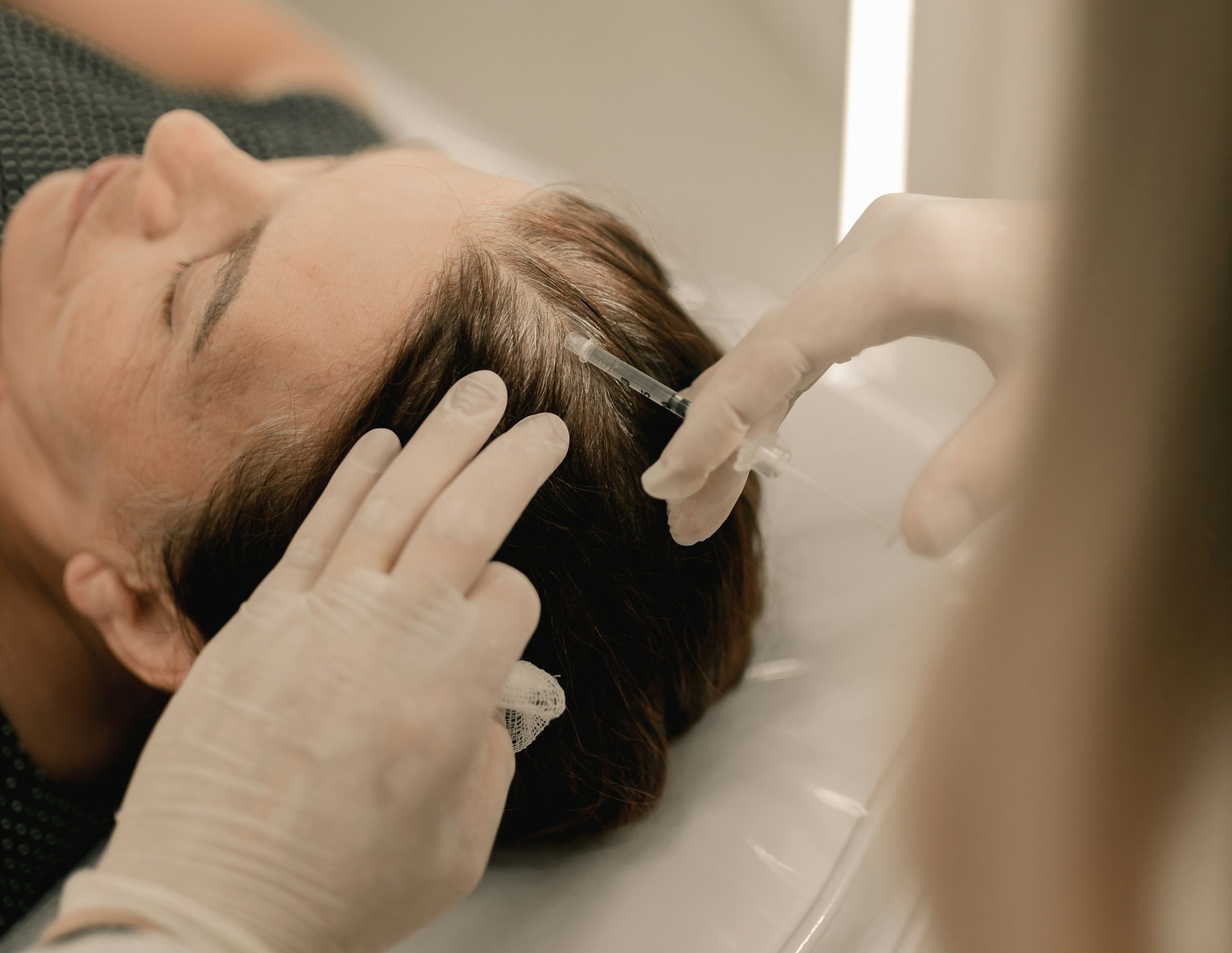 Ce que vous ne saviez pas sur la greffe de cheveux